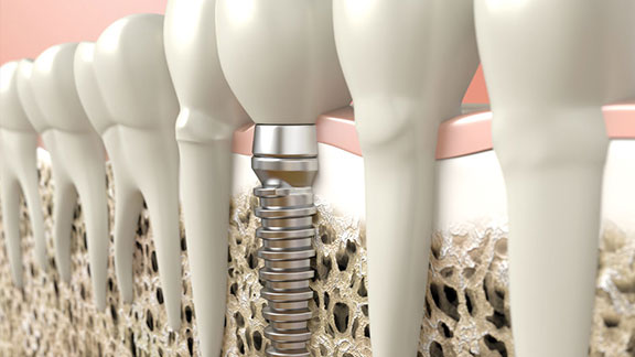 Gum Disease Treatment Bergen County, NJ